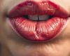 Трещины на губах: как быстро вернуть комфорт и мягкость